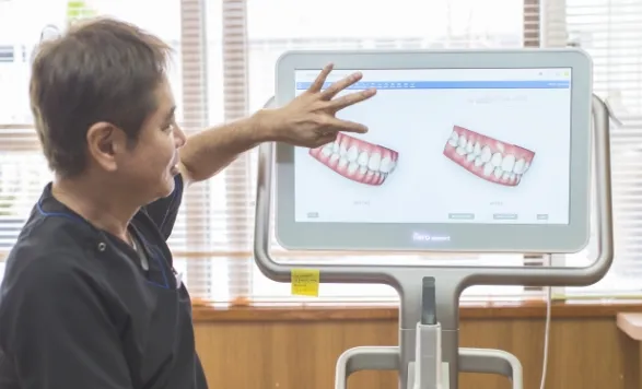 iTeroエレメント5D（口腔内スキャナー）