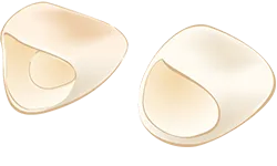 オールセラミック