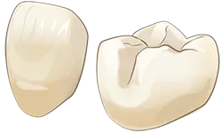 ハイブリッドセラミック